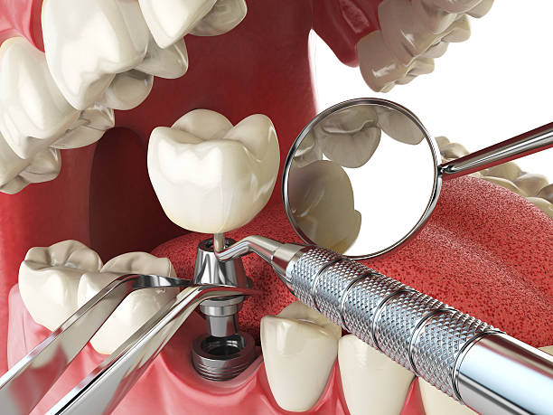 Best Walk-In Emergency Dentist in Arcade, GA